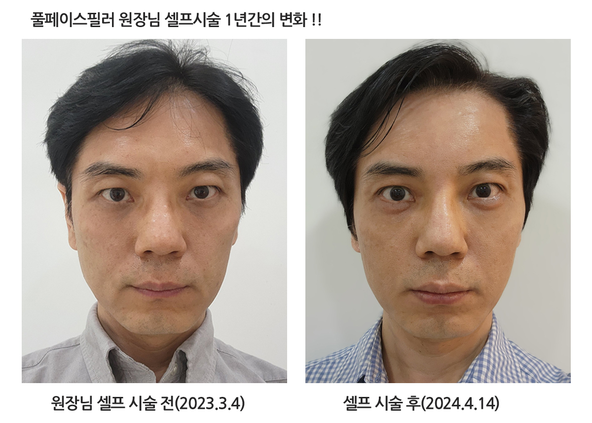 필러 전체 안내 자료 1