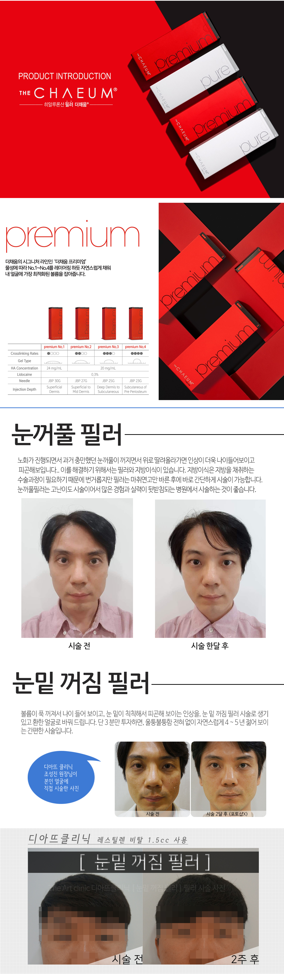 필러 크롭 안내 이미지 2