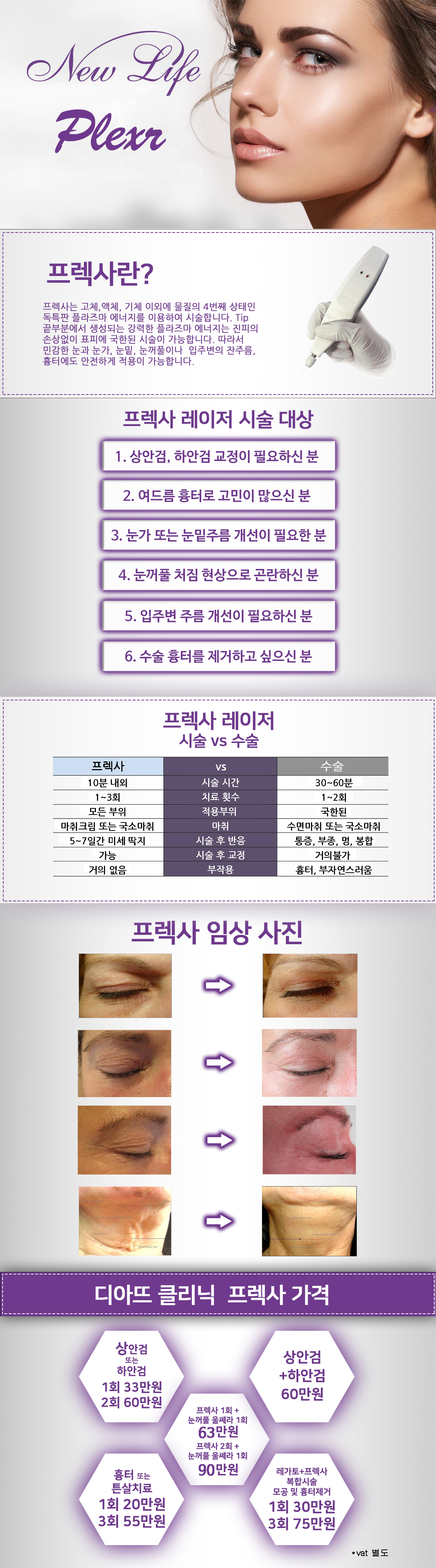 프렉사 상세 안내 이미지 2